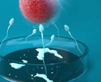 试管取出卵手术属于几级疼痛？